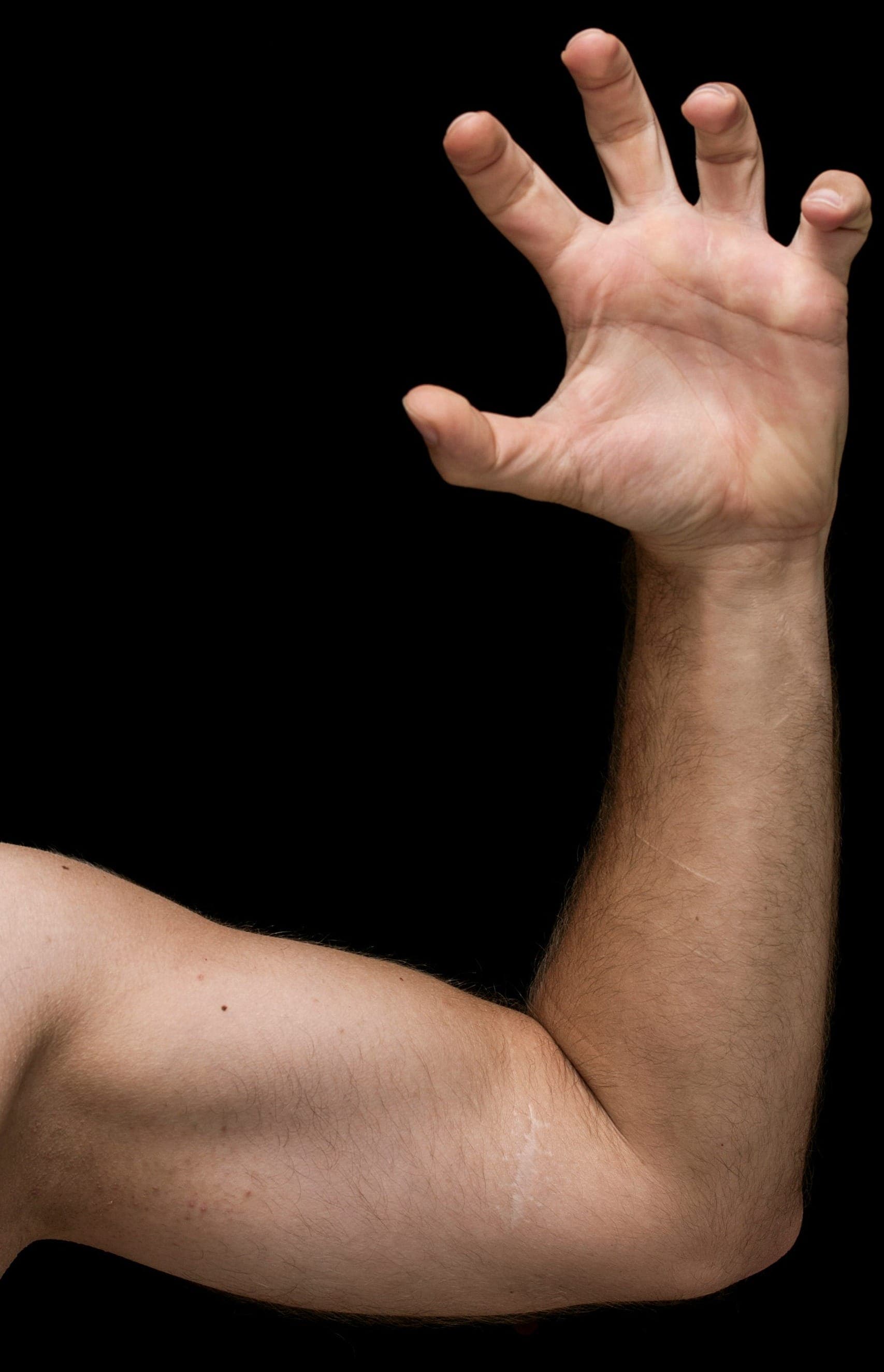 Best Arm Lift Surgeons in Dallas (2025 Guide)