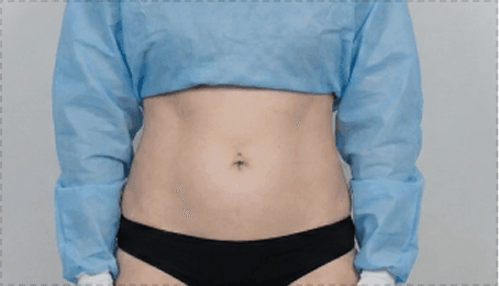 Moderate visualization