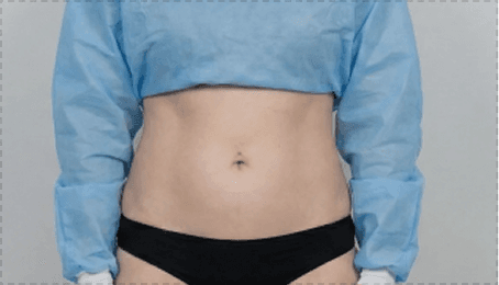 Subtle visualization